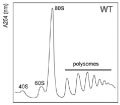 polysomes